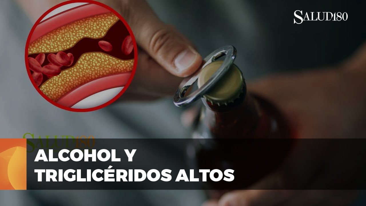 la cerveza sube el colesterol y triglicéridos