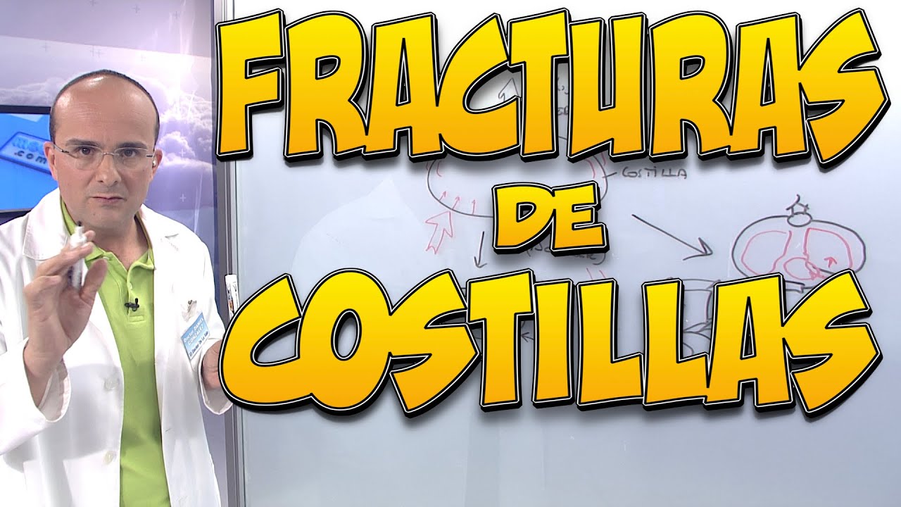 como saber si me he roto una costilla