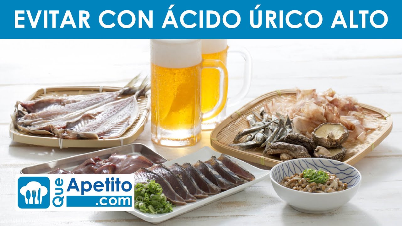 los calamares son malos para el ácido úrico